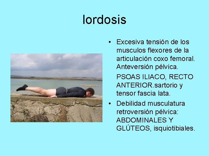 lordosis • Excesiva tensión de los musculos flexores de la articulación coxo femoral. Anteversión