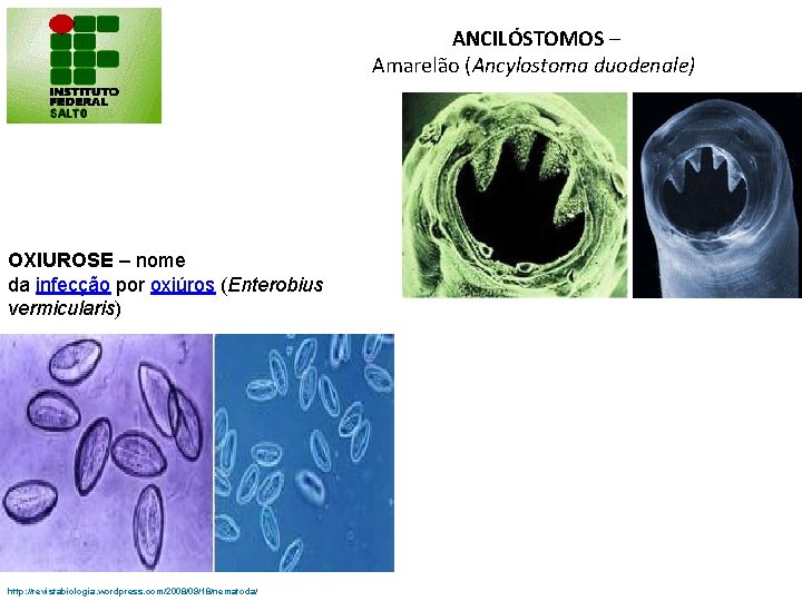 ANCILÓSTOMOS – Amarelão (Ancylostoma duodenale) OXIUROSE – nome da infecção por oxiúros (Enterobius vermicularis)