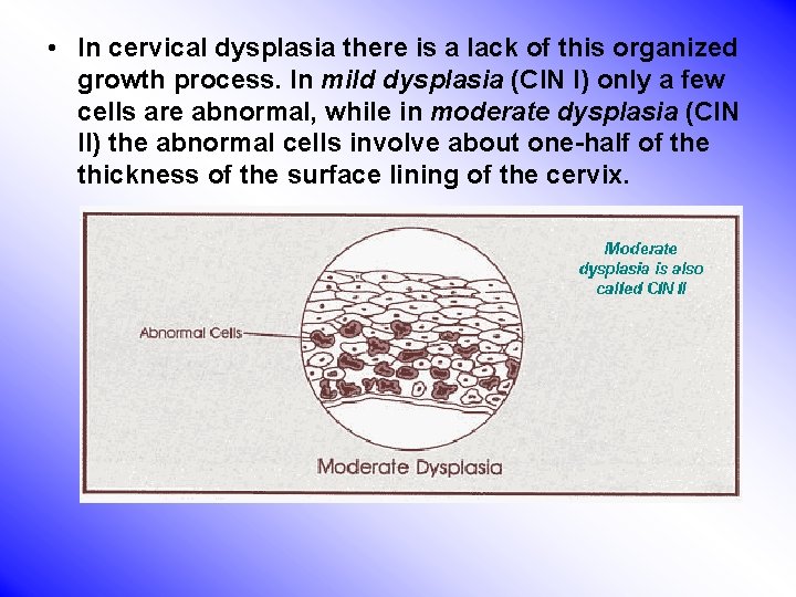  • In cervical dysplasia there is a lack of this organized growth process.