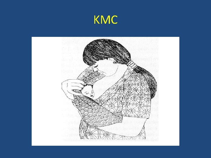 KMC 