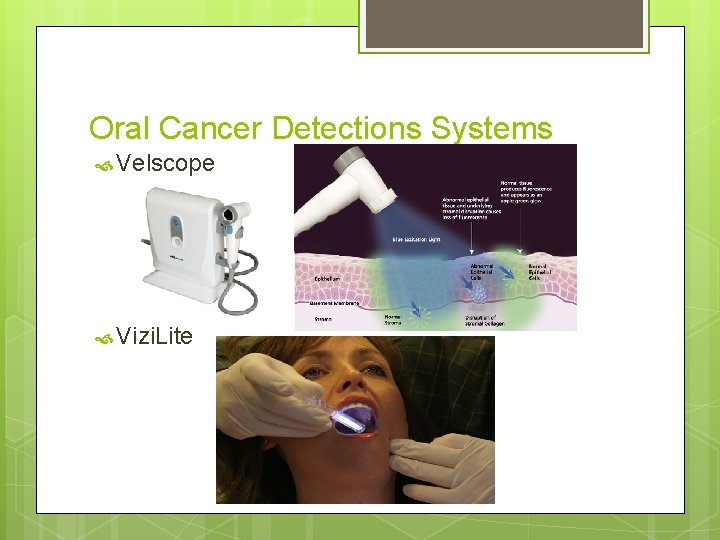 Oral Cancer Detections Systems Velscope Vizi. Lite 