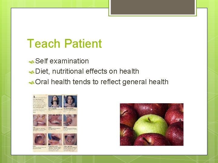 Teach Patient Self examination Diet, nutritional effects on health Oral health tends to reflect