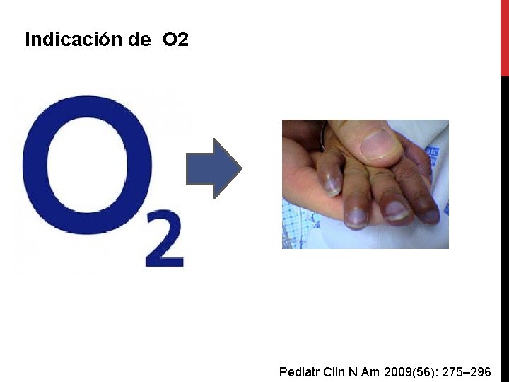 Indicación de O 2 Pediatr Clin N Am 2009(56): 275– 296 