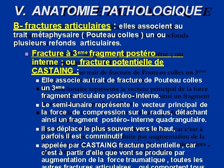V. ANATOMIE PATHOLOGIQUE B- fractures articulaires : elles associent au trait métaphysaire ( Pouteau