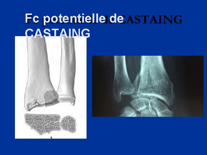 Fc potentielle de CASTAING 