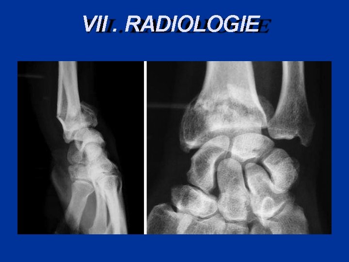 VII. RADIOLOGIE 