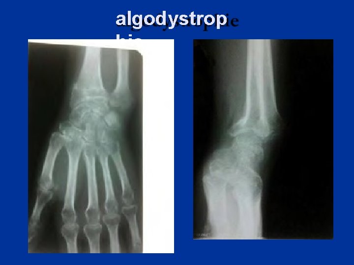 algodystrop hie 