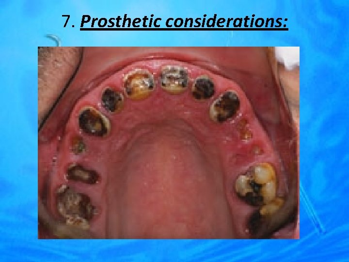 7. Prosthetic considerations: 