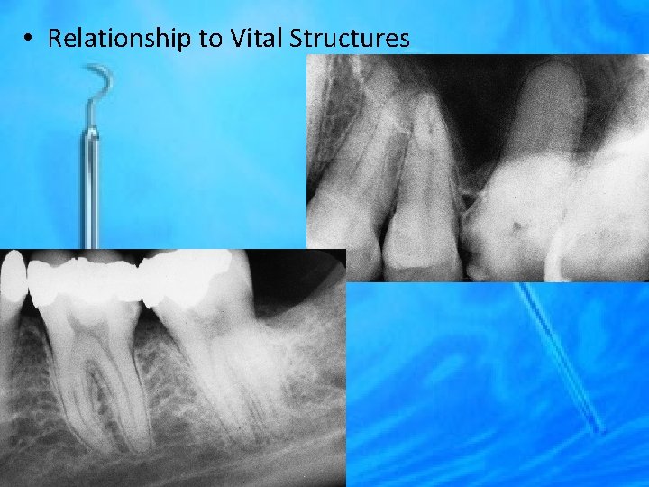  • Relationship to Vital Structures 