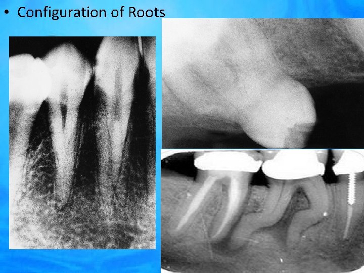  • Configuration of Roots 