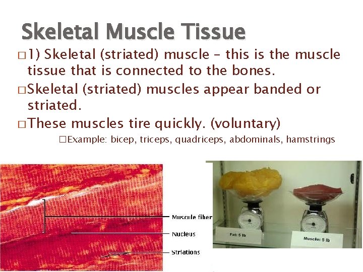 Skeletal Muscle Tissue � 1) Skeletal (striated) muscle – this is the muscle tissue