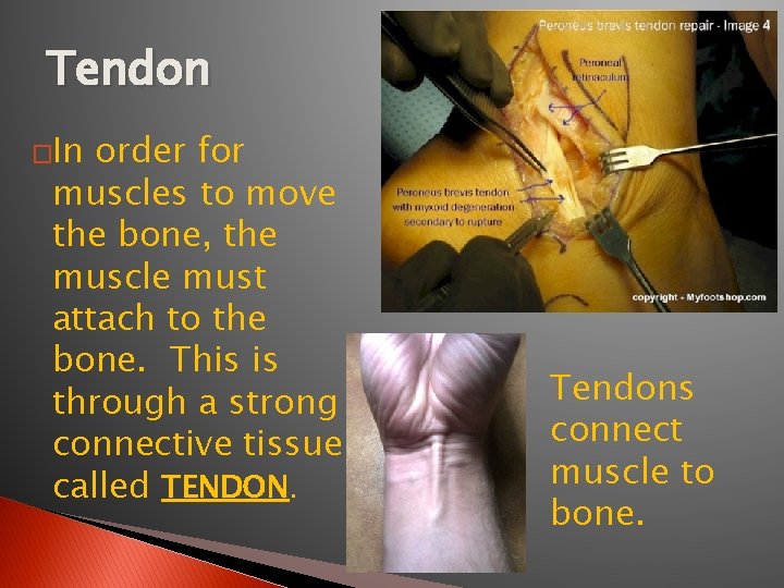 Tendon �In order for muscles to move the bone, the muscle must attach to