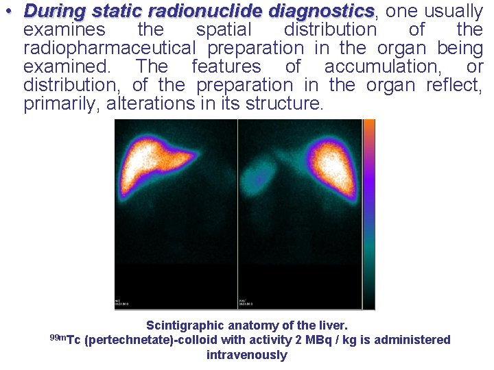  • During static radionuclide diagnostics, one usually diagnostics examines the spatial distribution of