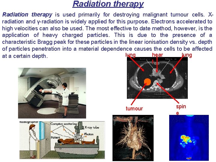Radiation therapy is used primarily for destroying malignant tumour cells. Xradiation and γ-radiation is