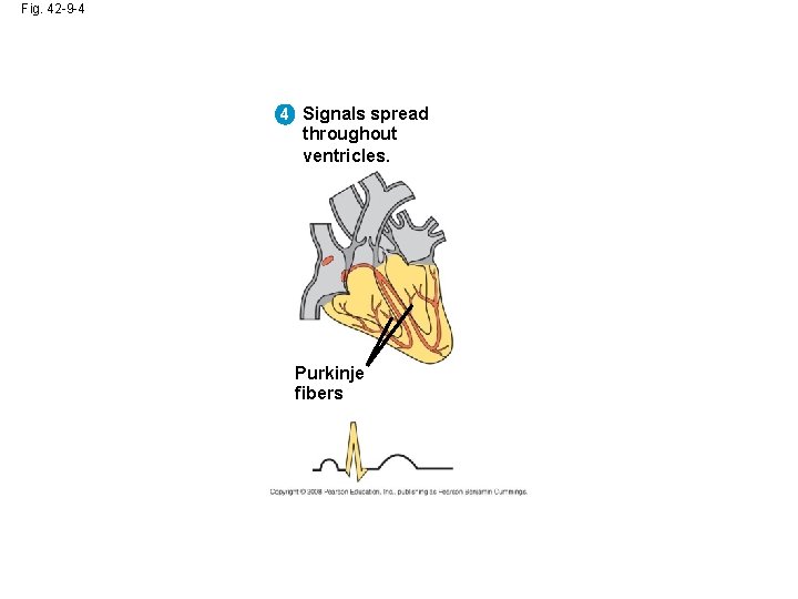 Fig. 42 -9 -4 4 Signals spread throughout ventricles. Purkinje fibers 