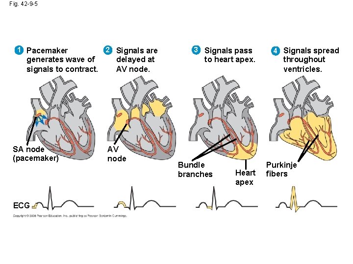 Fig. 42 -9 -5 1 Pacemaker generates wave of signals to contract. SA node