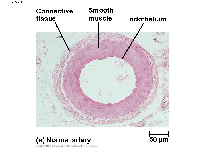 Fig. 42 -20 a Connective tissue Smooth muscle (a) Normal artery Endothelium 50 µm
