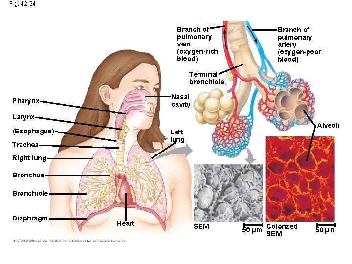 Fig. 42 -24 Branch of pulmonary vein (oxygen-rich blood) Branch of pulmonary artery (oxygen-poor