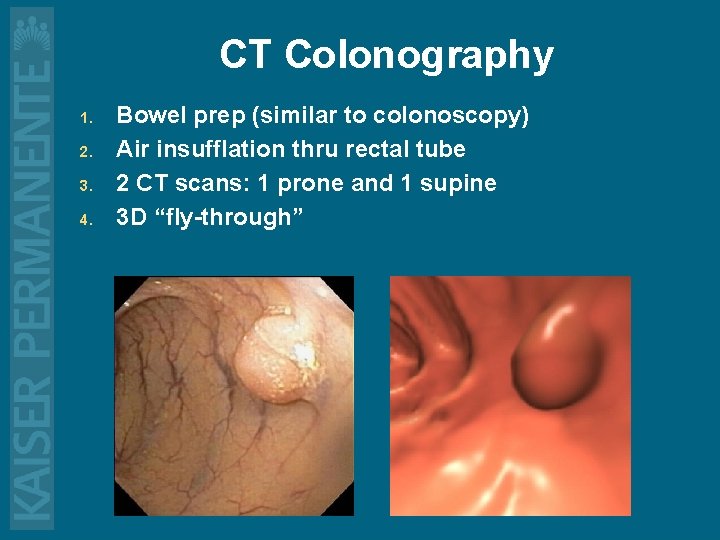 CT Colonography 1. 2. 3. 4. Bowel prep (similar to colonoscopy) Air insufflation thru