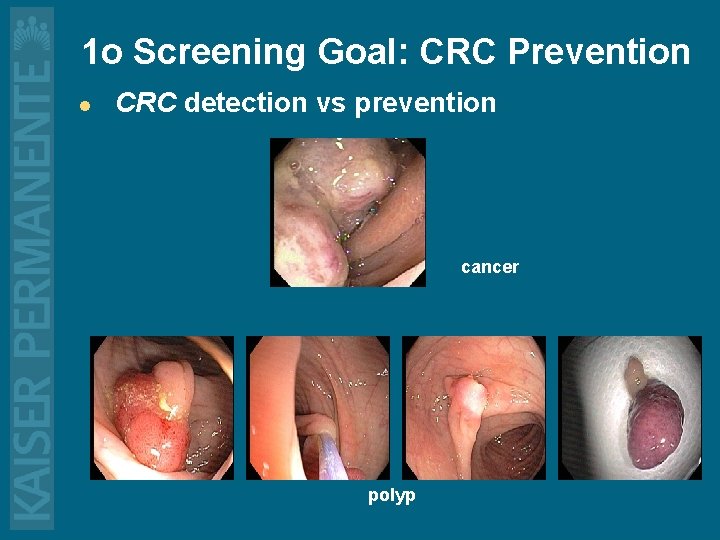 1 o Screening Goal: CRC Prevention l CRC detection vs prevention cancer polyp 
