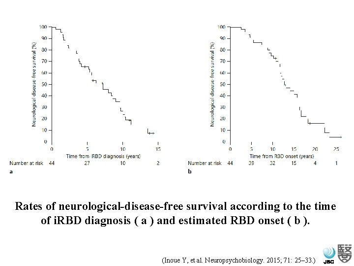 Rates of neurological-disease-free survival according to the time of i. RBD diagnosis ( a