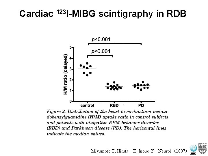 Cardiac 123 I-MIBG scintigraphy in RDB Miyamoto T, Hirata　K, Inoue Y　Neurol（2007） ＪＳＣ 