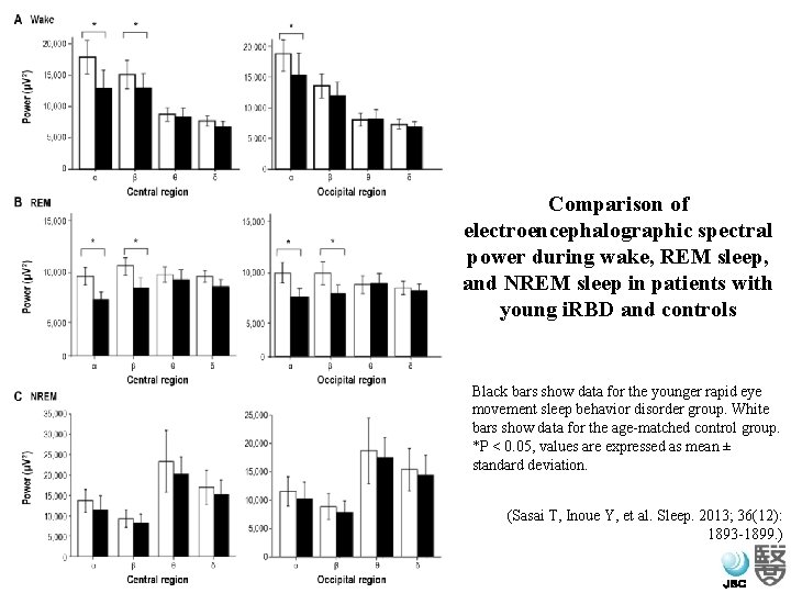 Comparison of electroencephalographic spectral power during wake, REM sleep, and NREM sleep in patients