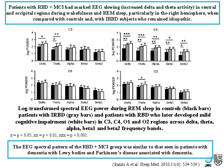 Patients with RBD + MCI had marked EEG slowing (increased delta and theta activity)