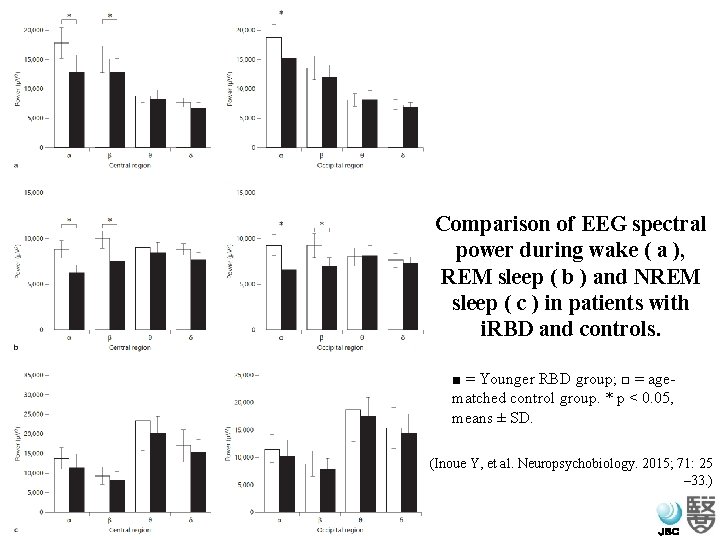 Comparison of EEG spectral power during wake ( a ), REM sleep ( b