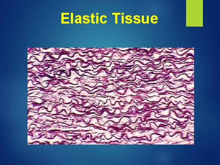 Elastic Tissue 