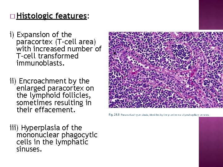 � Histologic features: i) Expansion of the paracortex (T-cell area) with increased number of