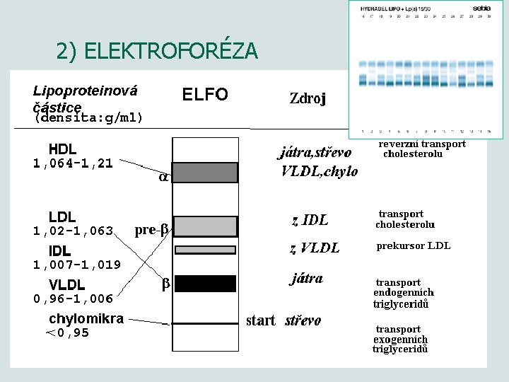 2) ELEKTROFORÉZA 25 