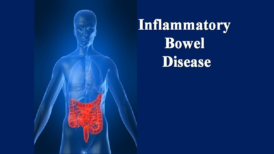 Inflammatory Bowel Disease 