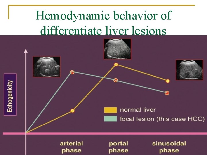 Hemodynamic behavior of differentiate liver lesions 