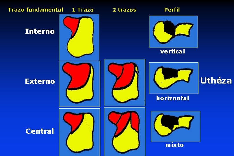 Trazo fundamental 1 Trazo 2 trazos Perfil Interno vertical Uthéza Externo horizontal Central mixto Trazo fundamental 1 Trazo 2 trazos Perfil Interno vertical Uthéza Externo horizontal Central mixto