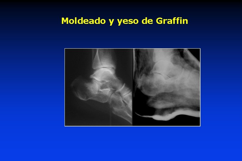 Moldeado y yeso de Graffin Moldeado y yeso de Graffin