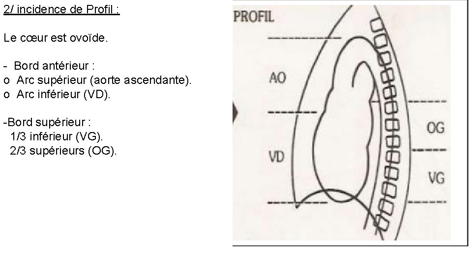 2/ incidence de Profil : Le cœur est ovoïde. - Bord antérieur : o