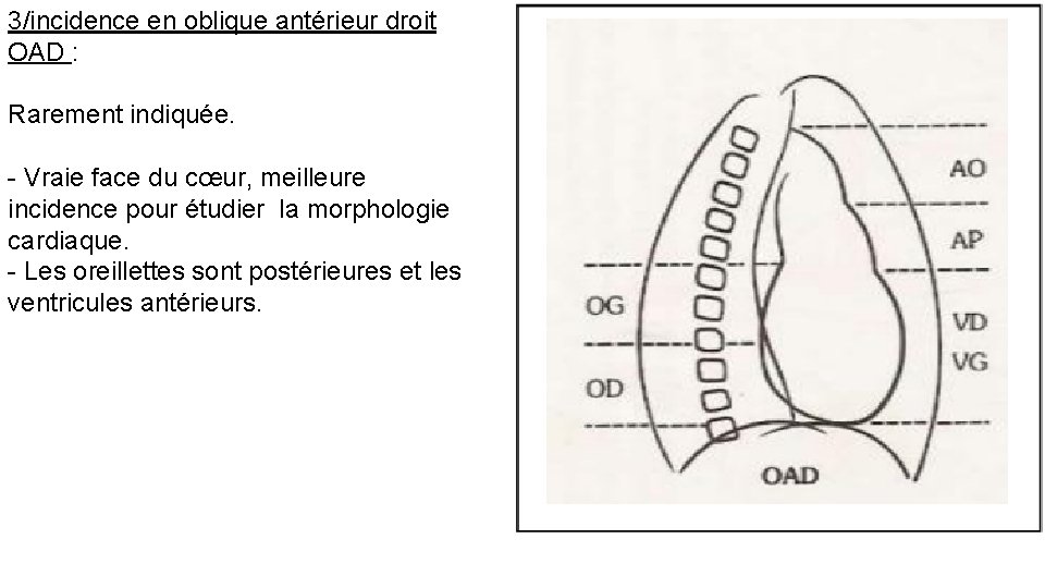 3/incidence en oblique antérieur droit OAD : Rarement indiquée. - Vraie face du cœur,