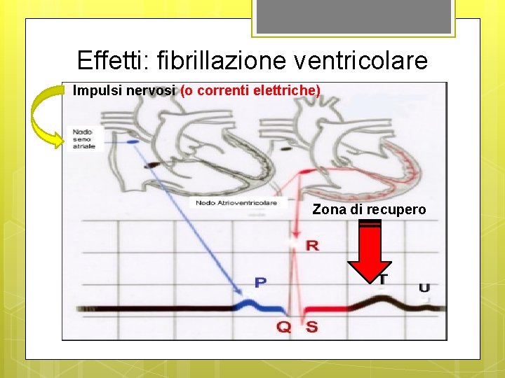 Effetti: fibrillazione ventricolare Impulsi nervosi (o correnti elettriche) Zona di recupero 