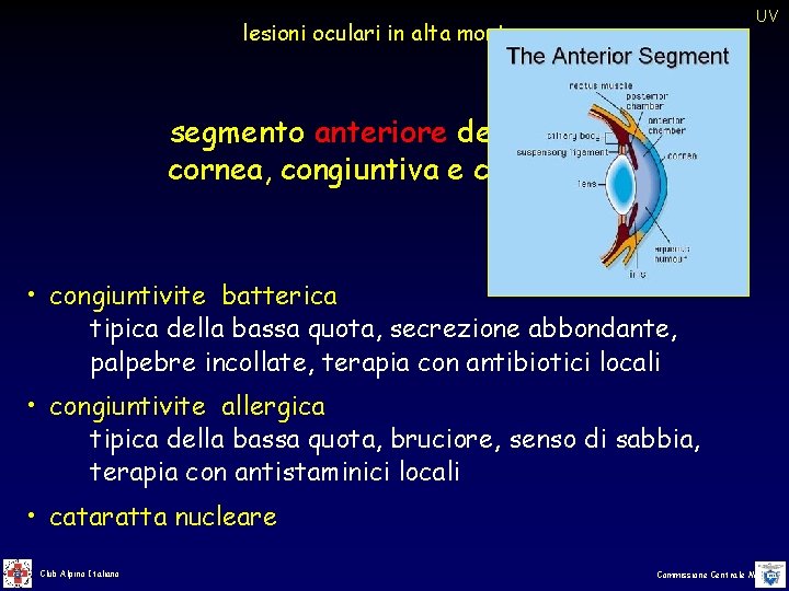 UV lesioni oculari in alta montagna segmento anteriore dell’occhio cornea, congiuntiva e cristallino • UV lesioni oculari in alta montagna segmento anteriore dell’occhio cornea, congiuntiva e cristallino •