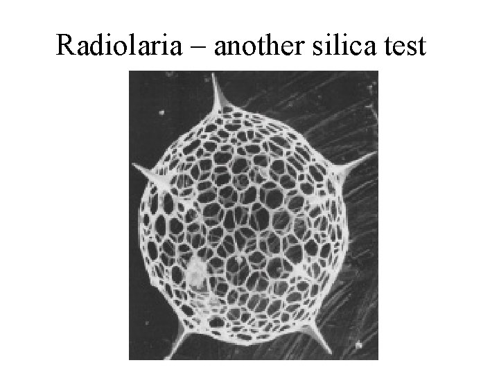 Radiolaria – another silica test 