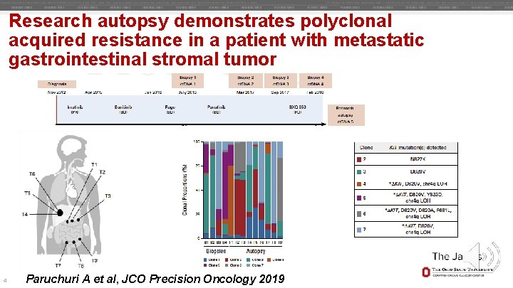 Research autopsy demonstrates polyclonal acquired resistance in a patient with metastatic gastrointestinal stromal tumor Research autopsy demonstrates polyclonal acquired resistance in a patient with metastatic gastrointestinal stromal tumor