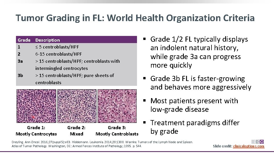 Tumor Grading in FL: World Health Organization Criteria Grade 1 2 3 a 3