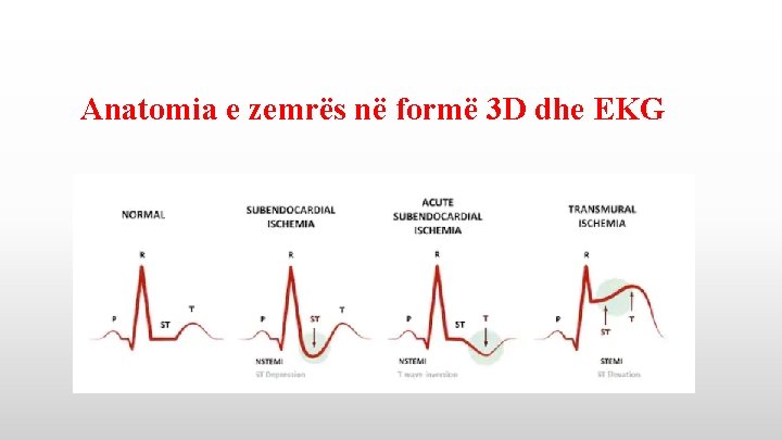 Anatomia e zemrës në formë 3 D dhe EKG 