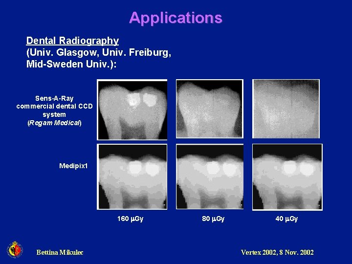 Applications Dental Radiography (Univ. Glasgow, Univ. Freiburg, Mid-Sweden Univ. ): Sens-A-Ray commercial dental CCD