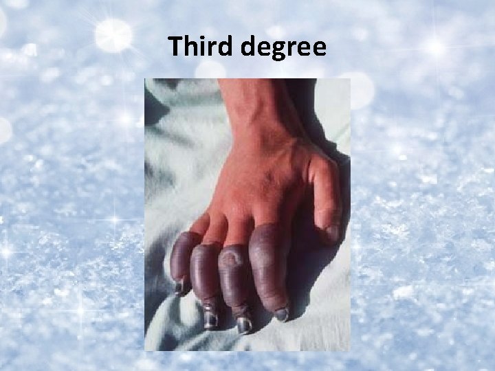 Third degree 