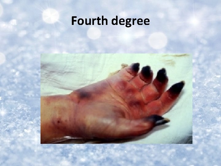 Fourth degree 