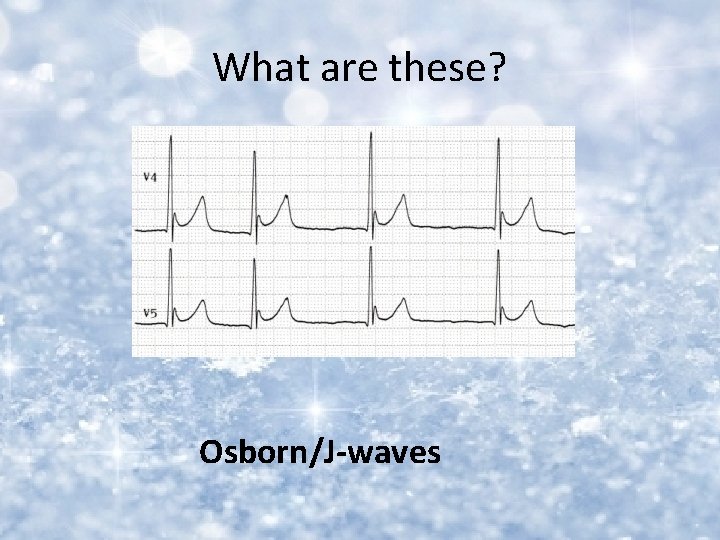 What are these? Osborn/J-waves 
