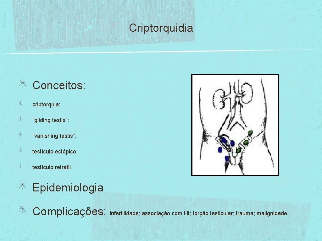 Criptorquidia Conceitos: criptorquia; “gliding testis”; “vanishing testis”; testículo ectópico; testículo retrátil Epidemiologia Complicações: infertilidade;