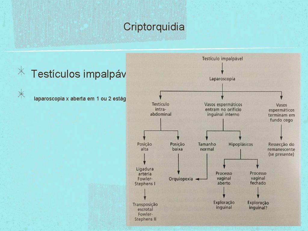 Criptorquidia Testículos impalpáveis: laparoscopia x aberta em 1 ou 2 estágios 